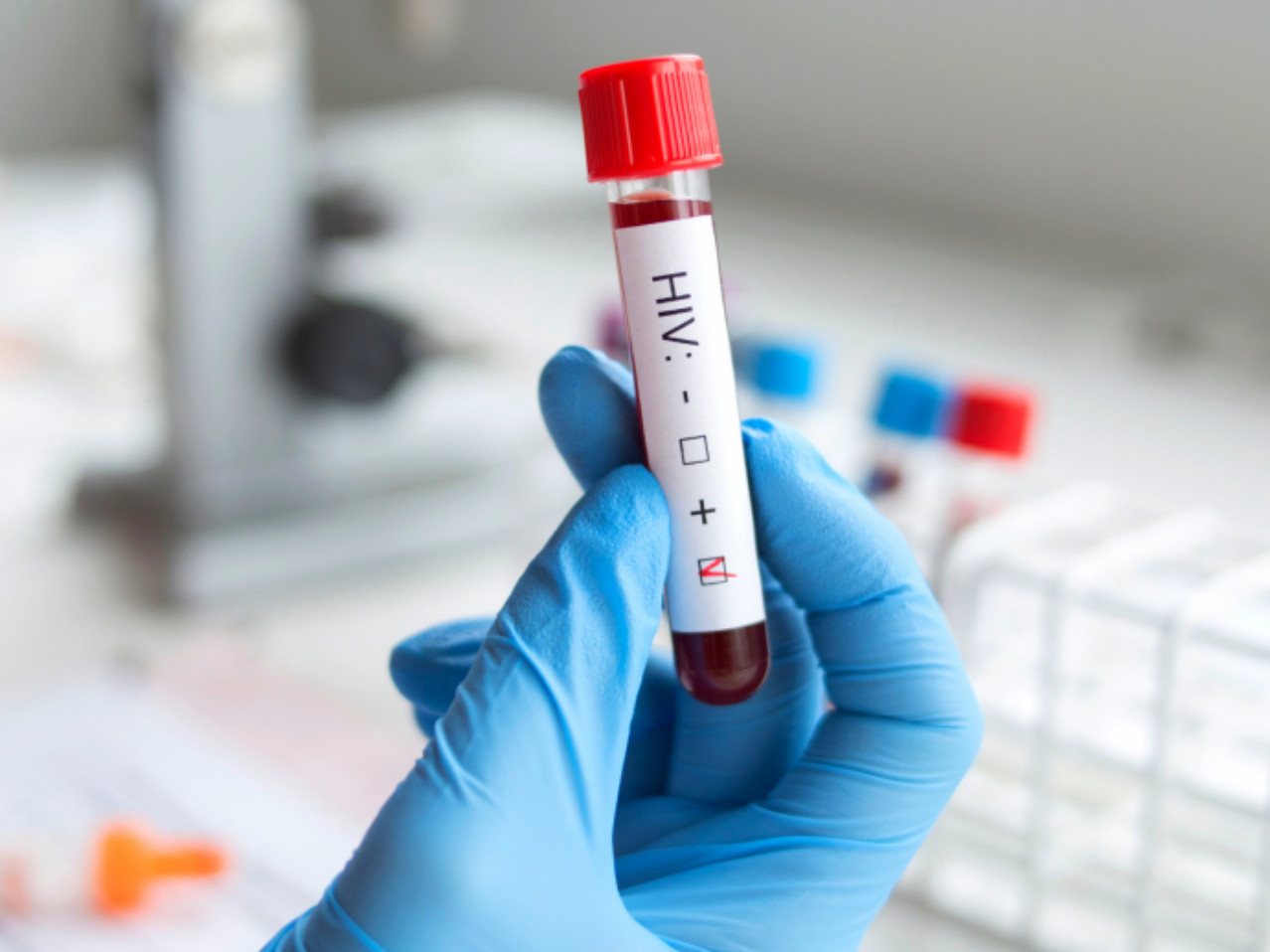 Новые лекарства могут помочь покончить со СПИДом, но доступ к ним может быть заблокирован